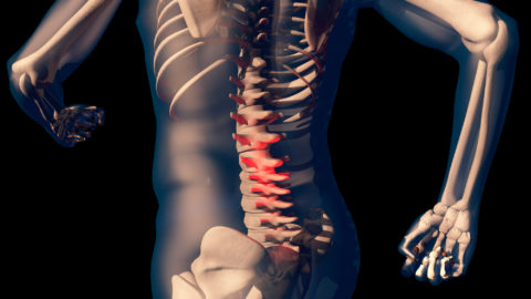 spinal-fusion-alternatives