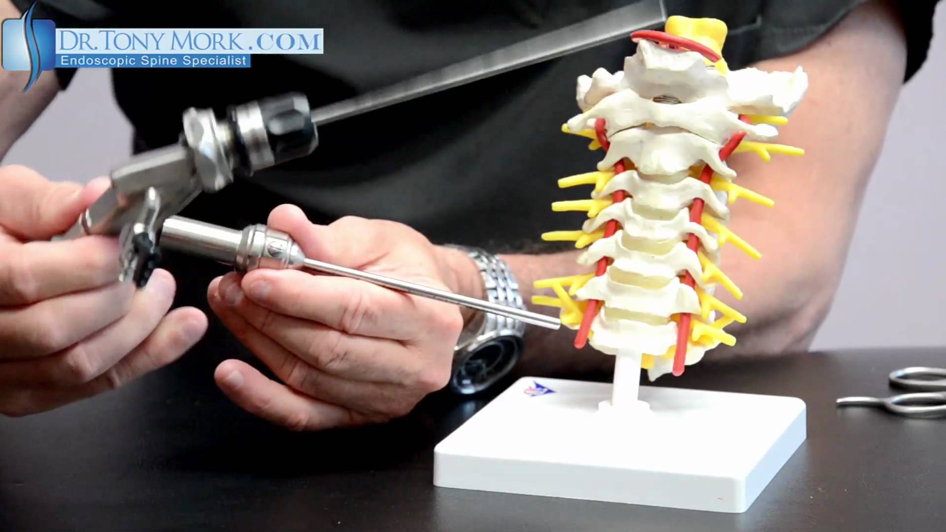 What does Minimally Invasive Spine Surgery (MISS) Mean? Dr. Tony Mork